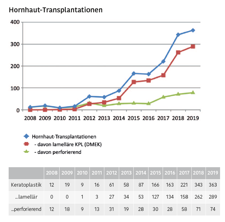Entwicklung der Zahl an Hornhauttransplantationen